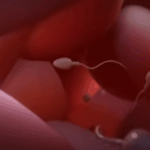 womb transplants in Kenya